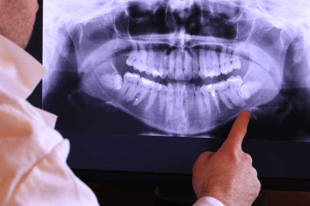 Best Pediatric Emergency Dentist in Fairlawn, OH