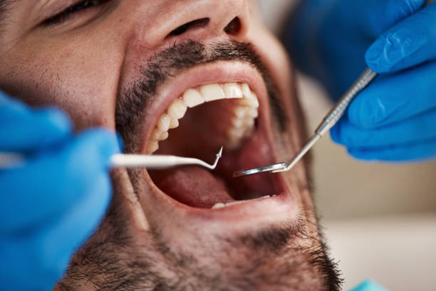 Best Emergency Treatment for Dental Infections or Abscesses in Fairlawn, OH